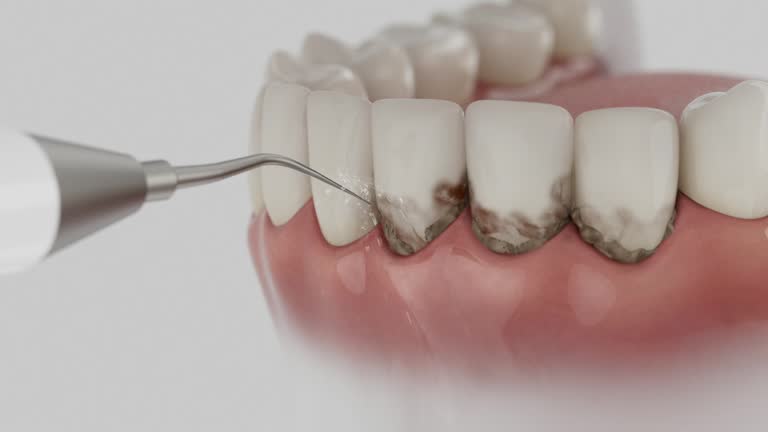Trusted Wisdom Tooth Removal service in Ashland, VA - Dentist Open Now